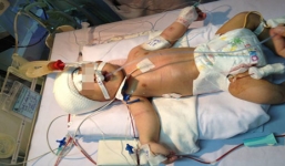 Vụ trẻ sơ sinh bị đâm: Bệnh viện không có khoản quỹ nào để đền bù 